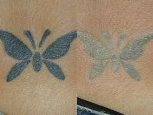 Buterfly tattoo.25860314 std
