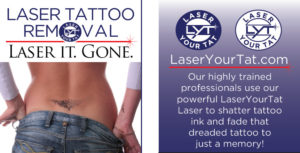 Laser your Tat banner