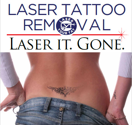 Find Laser Tattoo Removal Near You |Convenient And Effective